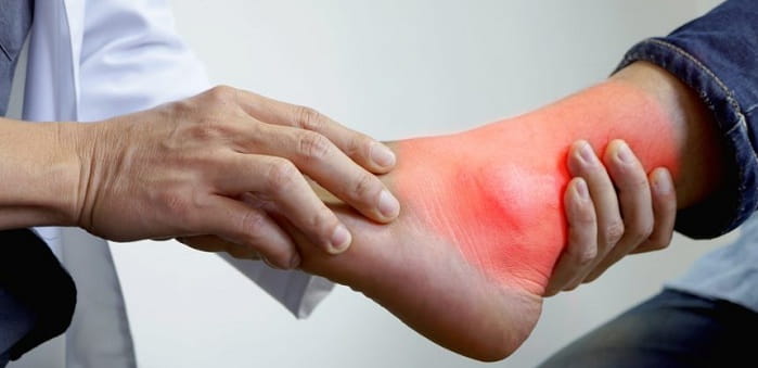  رهایی از دردهای نقرسی با نسخه‌ اعجاز‌انگیز سورنجان