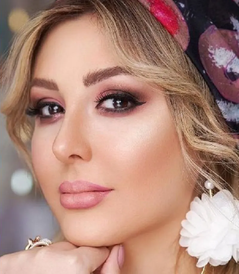 نیوشا ضیغمی بعد از عمل دوم