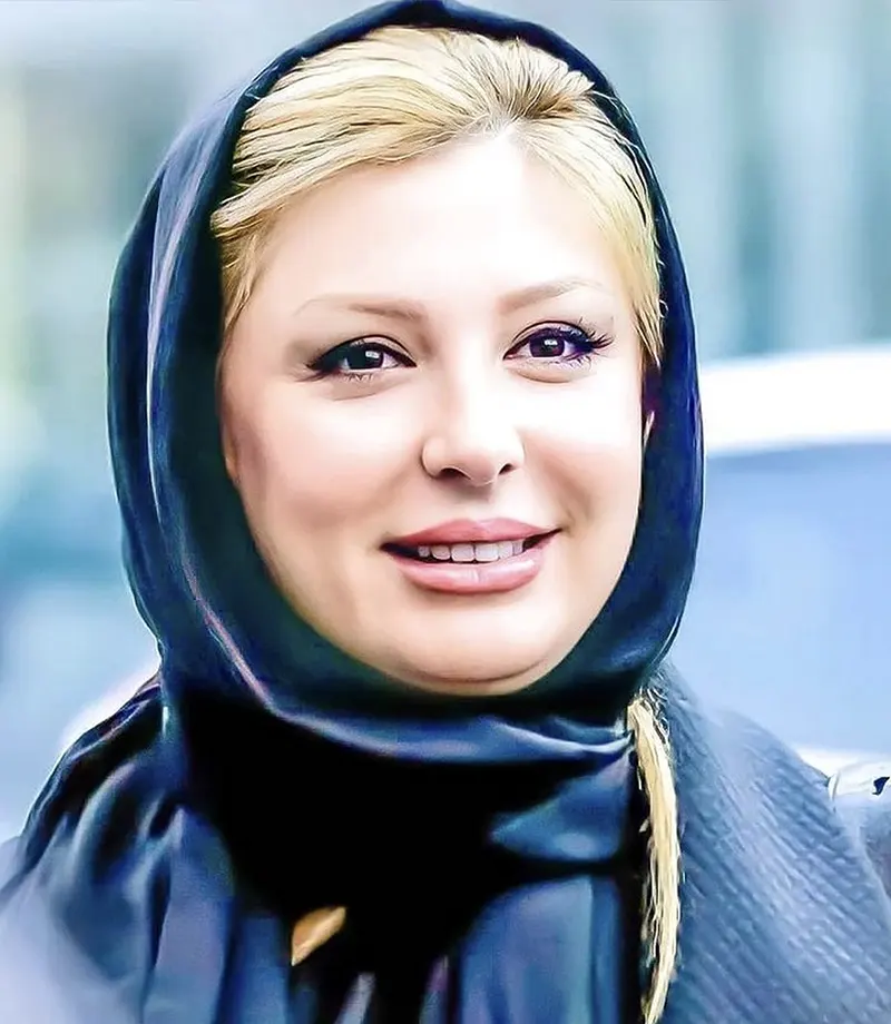 نیوشا ضیغمی قبل از عمل