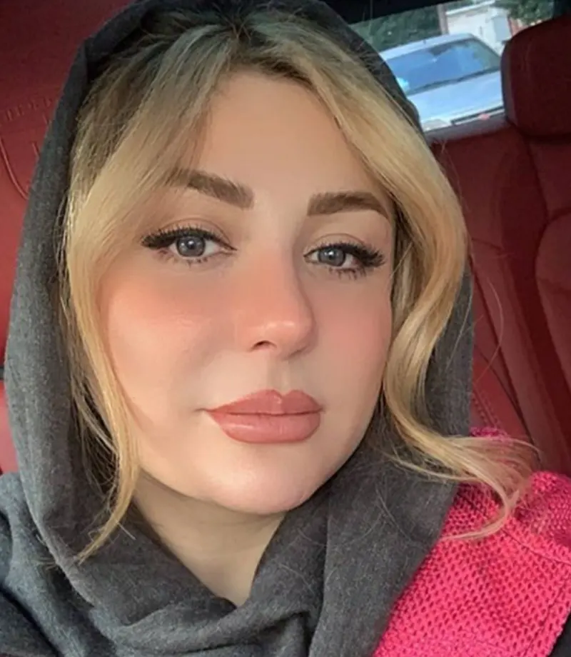 نیوشا ضیغمی بعد از عمل