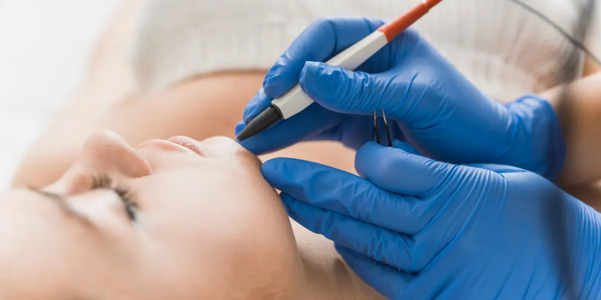 الکترولیز موهای زائد: راه حل موقت