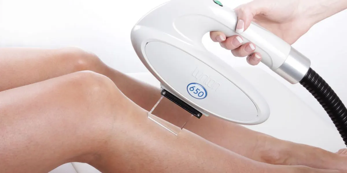 لیزر موهای زائد