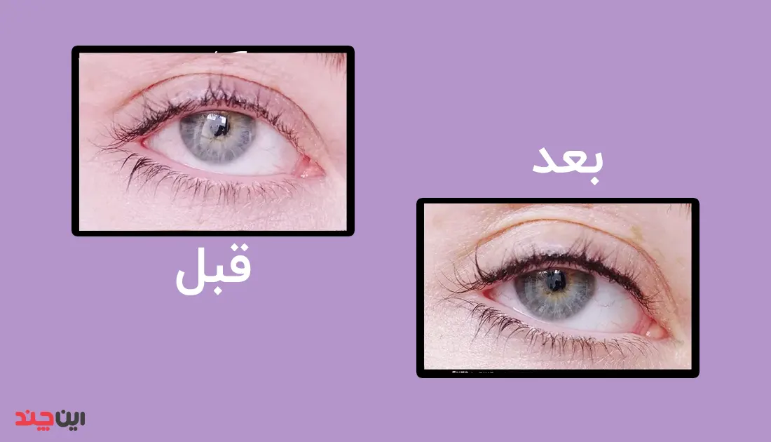 قبل و بعد تاتو خط چشم
